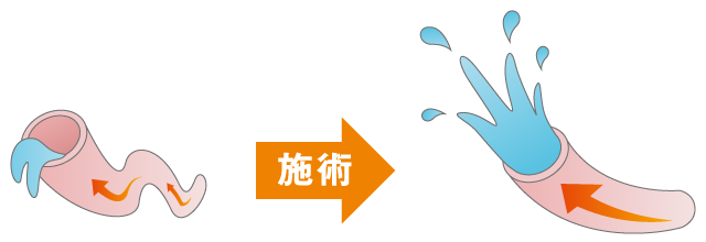 血液循環改善の図