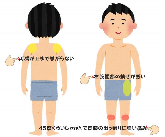 オスグッド病の症例その2画像