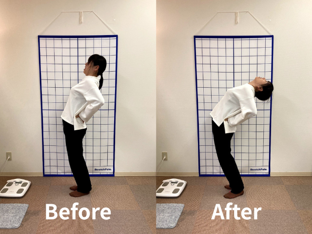 施術前後の様子